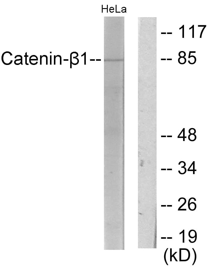 CTNNB1 / Beta Catenin Antibody (aa626-675)