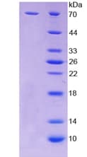 Human F2RL3 / PAR4 Protein (Recombinant His-GST)