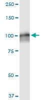 Monoclonal Mouse anti-Human AMPD2 Antibody (clone 6A8, WB)