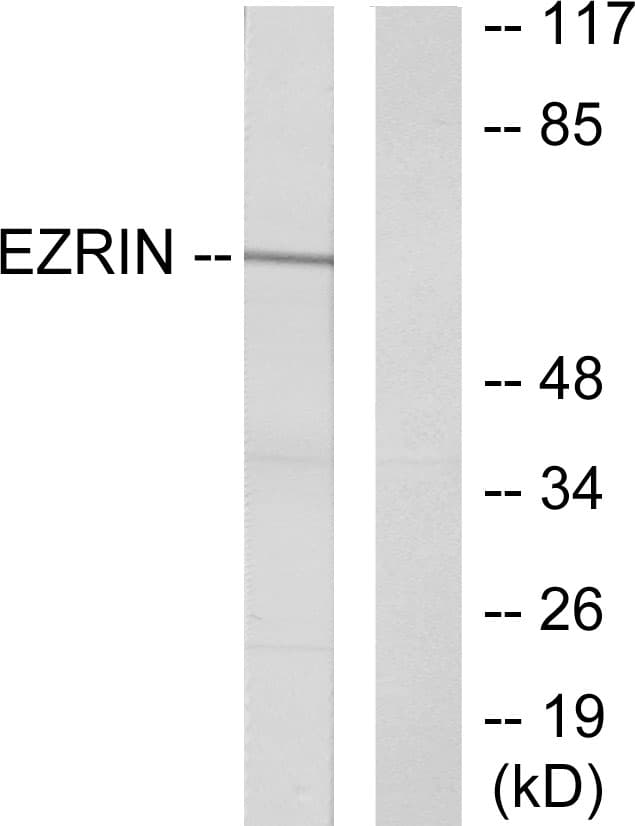 EZR / Ezrin Antibody (aa321-370)