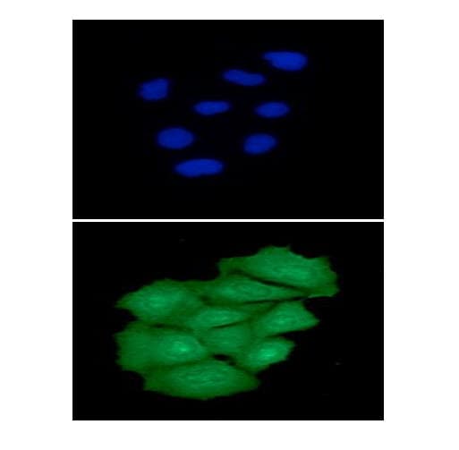 PNPLA2 / ATGL Antibody (clone AT18E6)