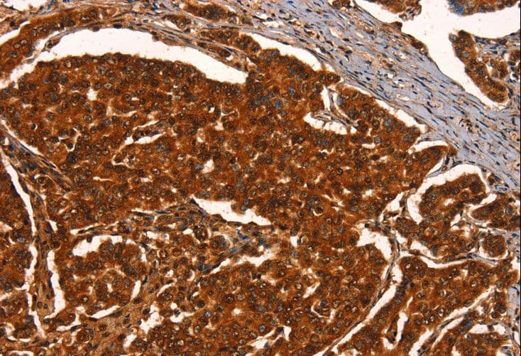 Polyclonal Rabbit anti-Human PRKD1 / PKC Mu Antibody (IHC, WB)