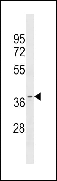 Polyclonal Rabbit anti-Human OR11A1 Antibody (aa279-306, WB)