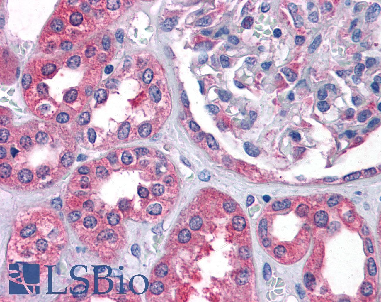 IHC-plus™ AS3MT Antibody (aa2-14)