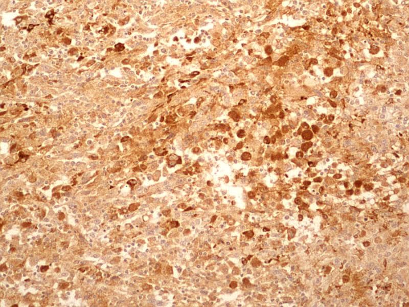 IL27RA Antibody (aa200-250, clone 34N4G11)