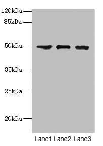 CSNK1G1 / CKI-Gamma 1 Antibody