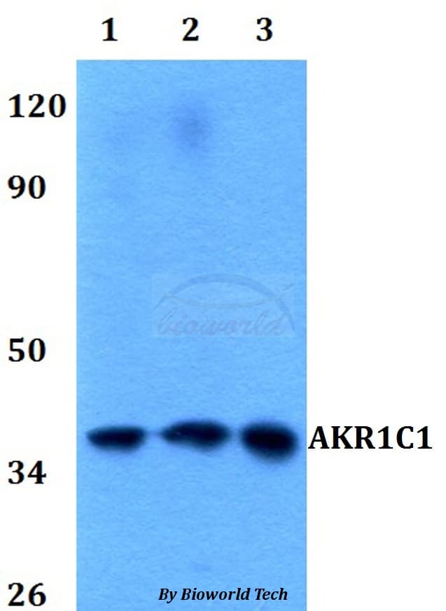 Polyclonal Rabbit anti-Human DDH / AKR1C1 Antibody (WB)