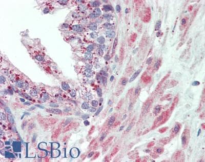IHC-plus™ ROR2 Antibody (aa475-525)