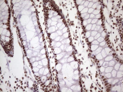 TP53BP1 / 53BP1 Antibody (aa1-300, clone OTI2H6)