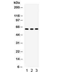 YES1 / c-Yes Antibody