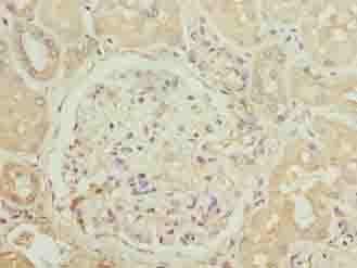 CCR1 Antibody