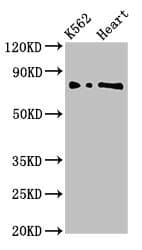 Polyclonal Rabbit anti-Human L3MBTL2 Antibody (IF, WB)