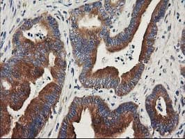 BCAR1 / p130Cas Antibody (clone OTI1B1)