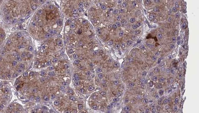 OR2T6 Antibody