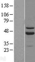 RORB / ROR Beta Protein (Over-Expression Lysate Myc-DDK (Flag))