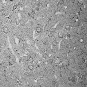 RHOA Antibody (aa100-150)