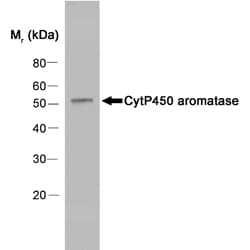 Monoclonal Mouse anti-Human CYP19 / Aromatase Antibody (clone H4, Concentrated, aa376-390, IHC, IF, WB)