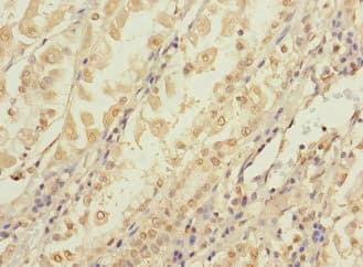 Polyclonal Rabbit anti-Human CCDC150 Antibody