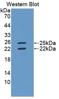 IFN Gamma / Interferon Gamma Antibody (aa24-166, PE)
