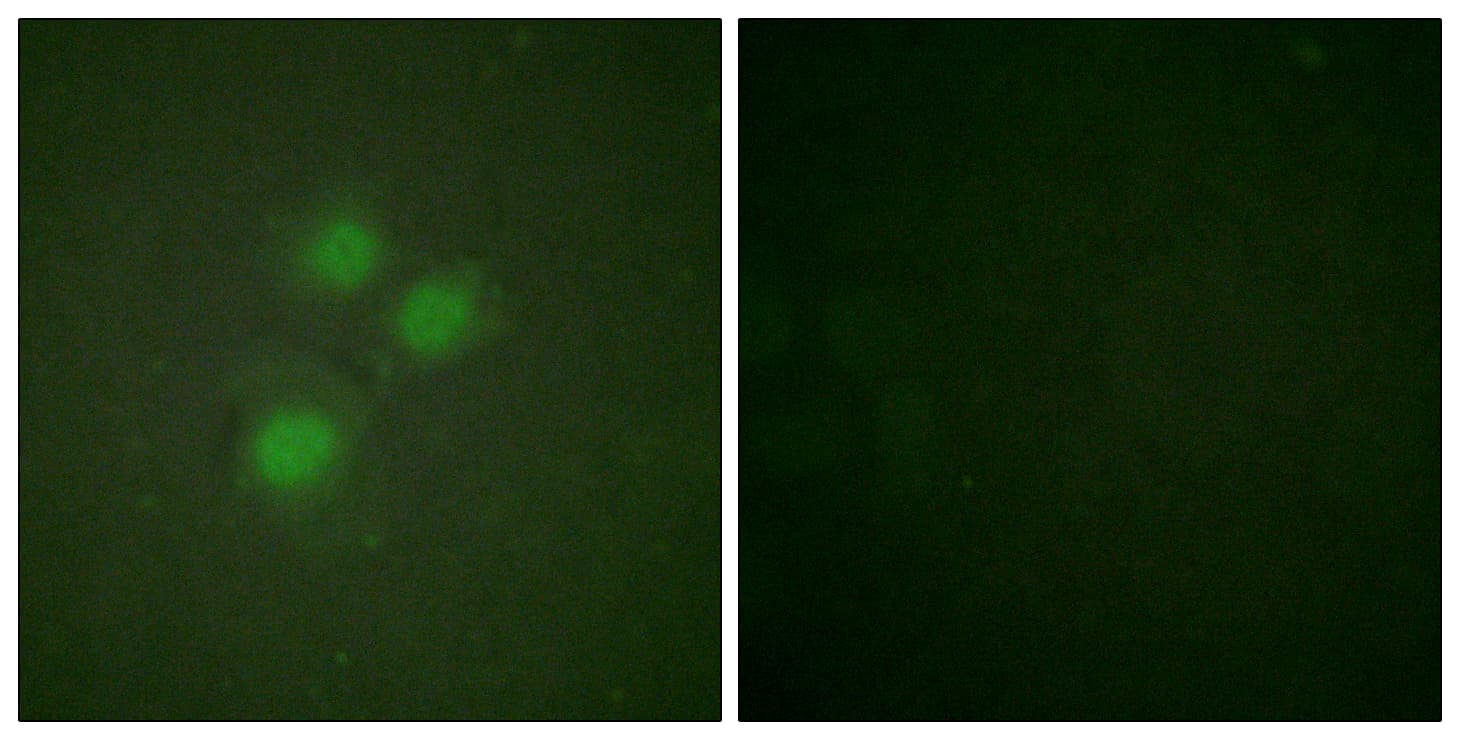 Polyclonal Rabbit anti-Human NIFK / MKI67IP Antibody (aa200-249, IHC, IF)