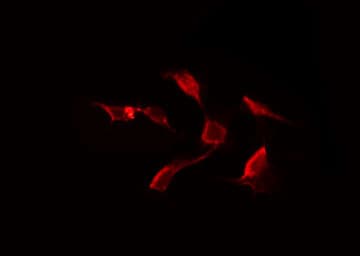 CLEC6A / Dectin 2 Antibody