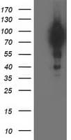 BCAR1 / p130Cas Antibody (clone OTI3A11)