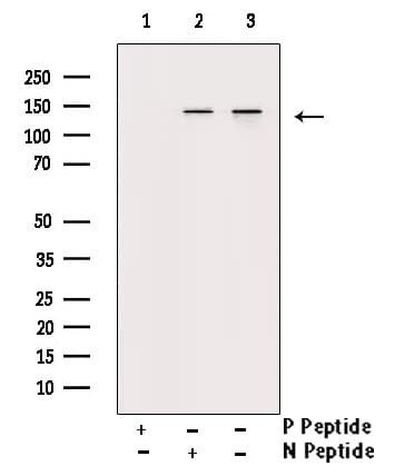 Polyclonal Rabbit anti-Human ABL1 / c-ABL Antibody (phospho-Tyr204, IF, WB)