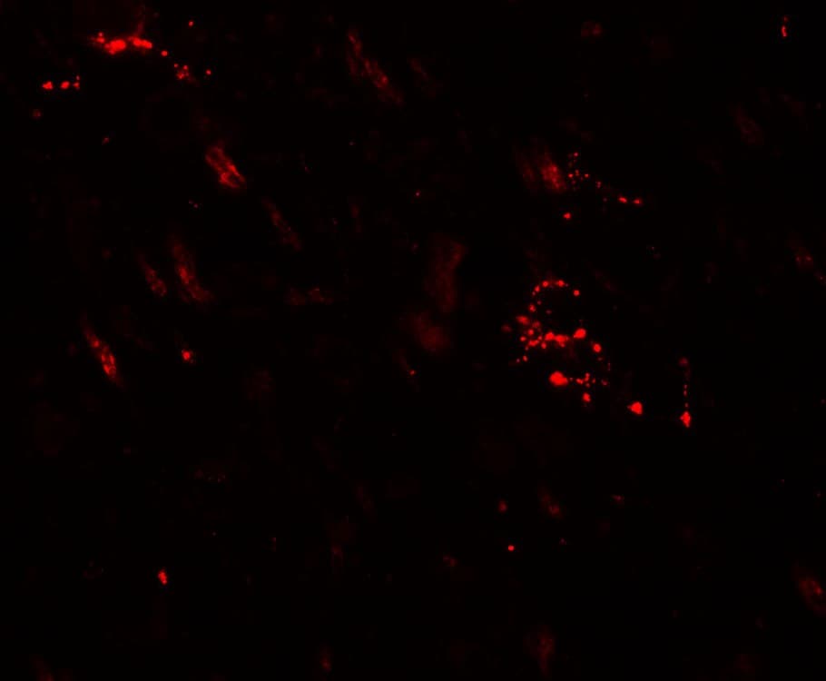 IHC-plus™ MAP1LC3A / LC3A Antibody
