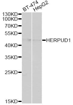 HERPUD1 / HERP Antibody
