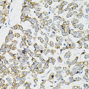 PPP1CA / PP1-Alpha Antibody