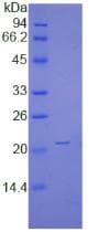 Human NME1 / NM23 Protein (Recombinant His-T7)