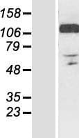 RANBP10 Protein (Over-Expression Lysate Myc-DDK (Flag))