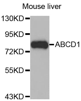IHC-plus™ Polyclonal Rabbit anti-Human ALDP / ABCD1 Antibody (IHC, WB)