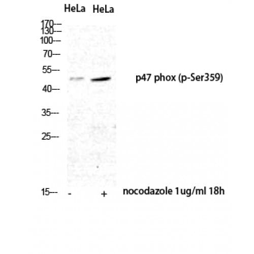 NCF1 / p47phox / p47 phox Antibody (300-380 aa)