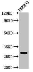 Polyclonal Rabbit anti-Human ANKRD49 Antibody
