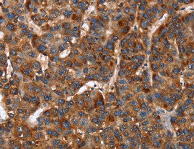 CACNB2 Antibody