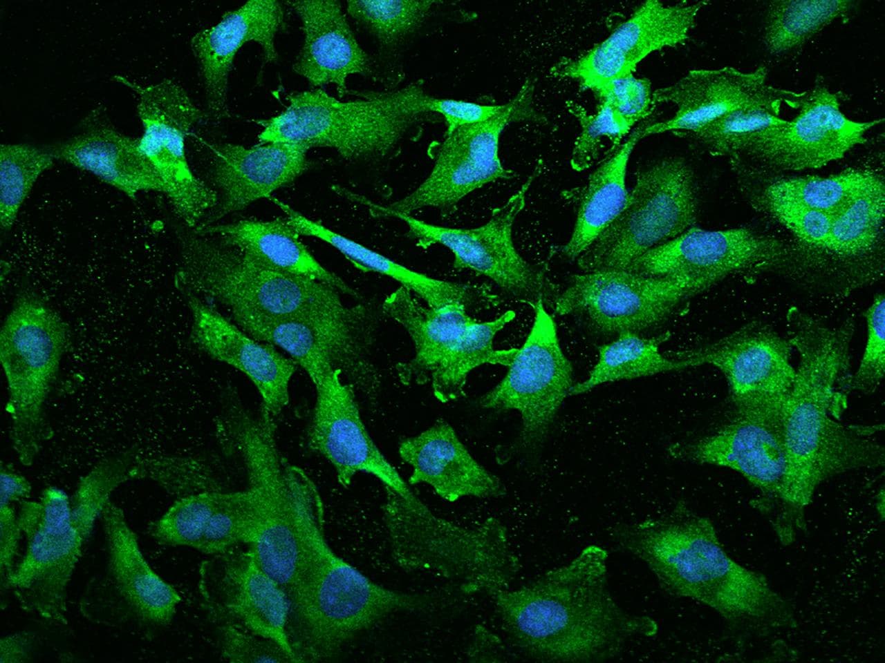 Polyclonal Rabbit anti-Human BTF3 Antibody (IHC, IF)