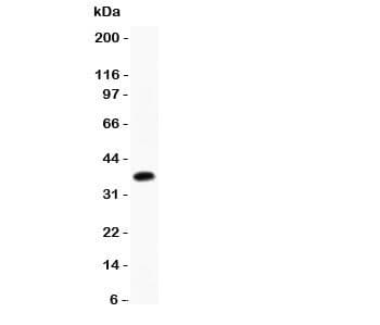 FCER2 / CD23 Antibody (aa50-331)