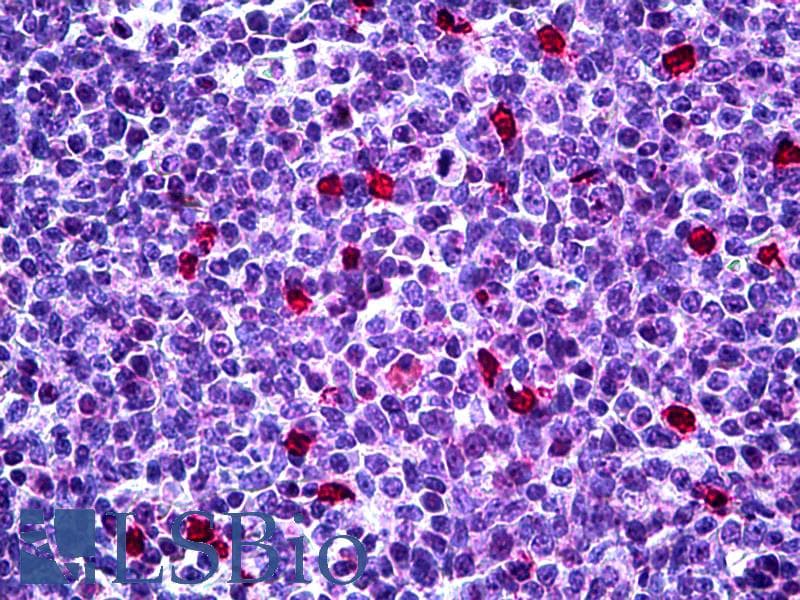 IHC-plus™ Monoclonal Mouse anti-Human CDKN1B / p27 Kip1 Antibody (clone 4B4-E6, IHC, IF, WB)
