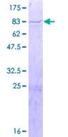 Human KIF12 Protein (Recombinant GST)