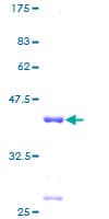 Human RPL30 / Ribosomal Protein L30 (Recombinant GST)