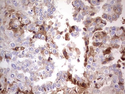 Monoclonal Mouse anti-Human CFI / Complement Factor I Antibody (clone OTI15E11, Carrier-free, aa340-583, IHC, WB)