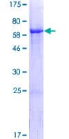 Human ALS2CR1 / NIF3L1 Protein (Recombinant GST)