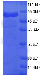 Human GPT / Alanine Transaminase Protein (Recombinant His)
