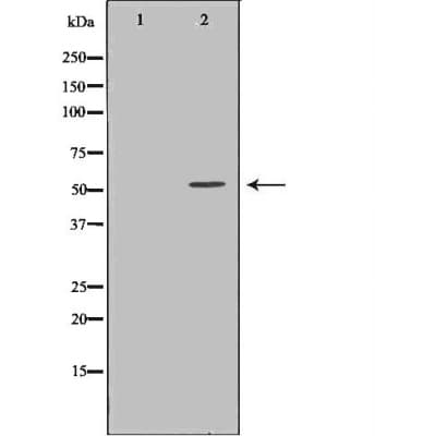 Polyclonal Rabbit anti-Human TXNRD2 Antibody (IHC, IF, WB)