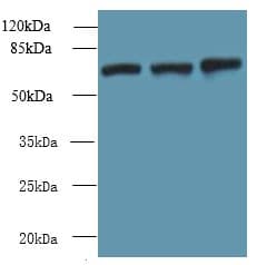 Polyclonal Rabbit anti-Human SWAP70 Antibody (WB)