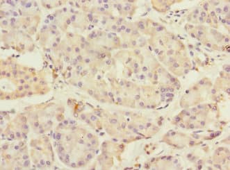 Polyclonal Rabbit anti-Human TMED1 / ST2L Antibody (IHC)