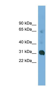 CCDC127 Antibody (aa35-84)