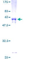 Human VDAC2 Protein (Recombinant GST)