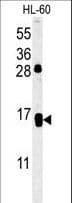CD69 Antibody (aa119-148)